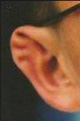 Andrew Gosden's ear